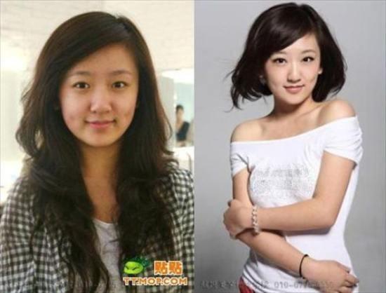 antes e depois com asiaticas (4)