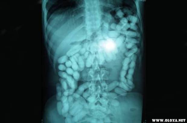 arte da apreensao 20