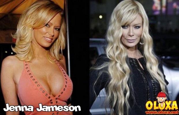 celebridades ontem e hoje (4)