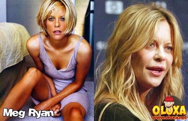 celebridades ontem e hoje (6)