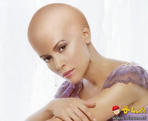 celebrities-photoshopped-bald-18