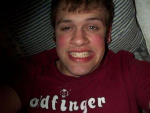 consequencias da fesa duro do fim de semana 11