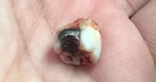 Dente para bala e salva turista que levou tiro na nuca em assalto