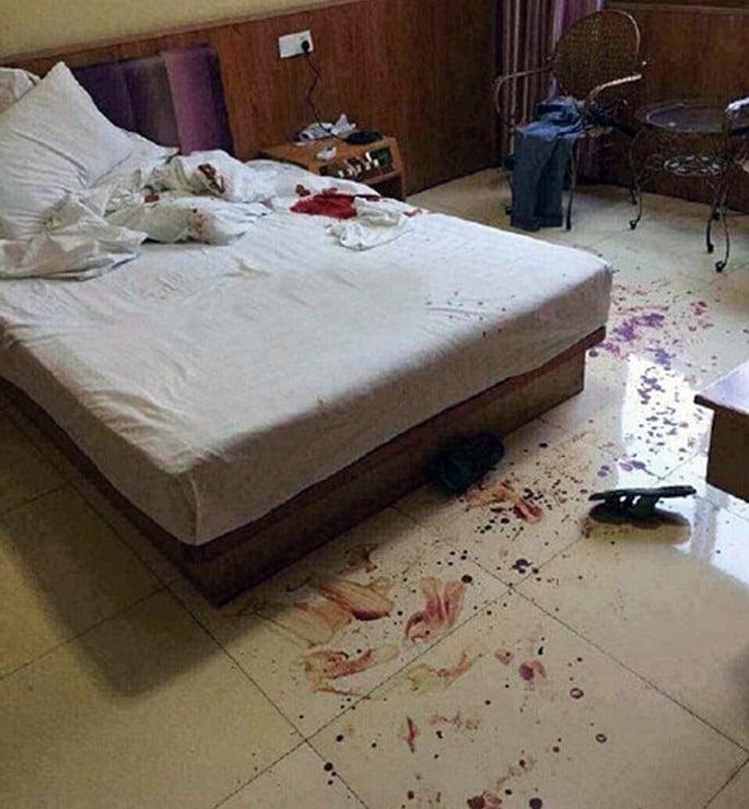 homem tem pênis decepado em motel