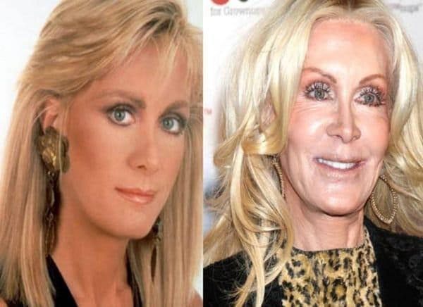 Celebridades que destruirão seus corpos com a plasticas 