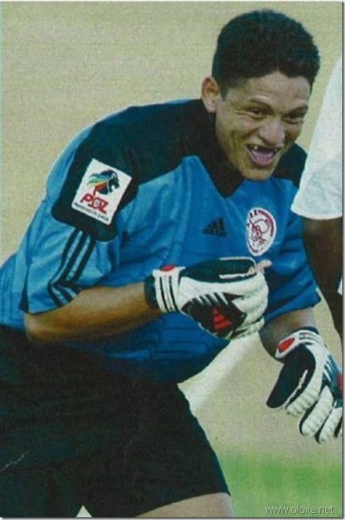 soccer-lose-teeth-dentures-2