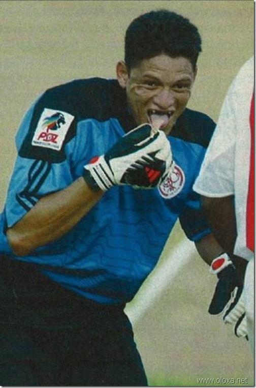 soccer-lose-teeth-dentures-4