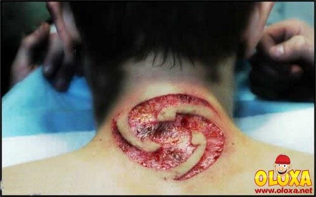 weird-scarification25