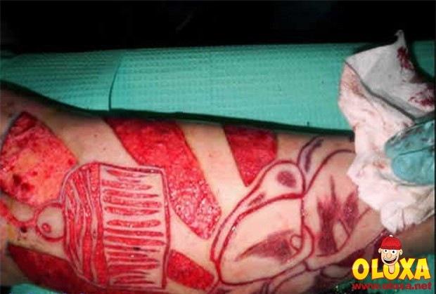 weird-scarification28