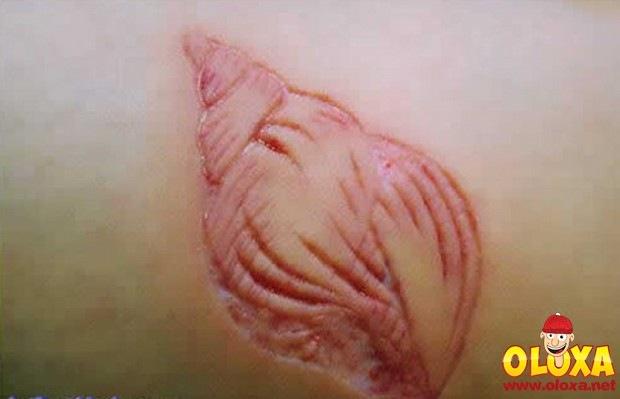 weird-scarification29